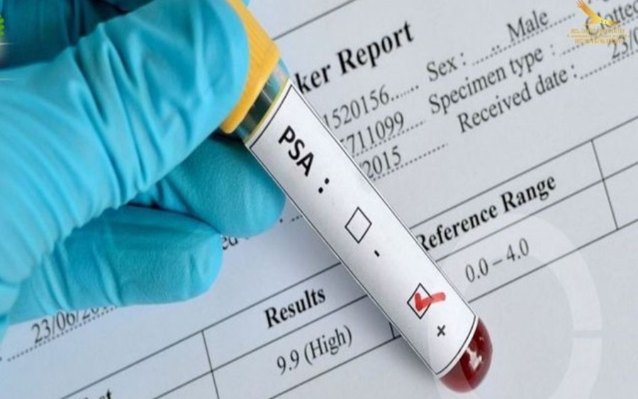 Inamen desarrolla campaña gratuita de detección temprana de Cáncer de Próstata para varones mayores de 40 años