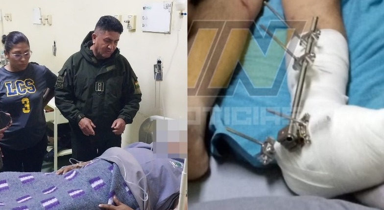 Policía gravemente herido por explosión de dinamita en Parotani será sometido a más cirugías