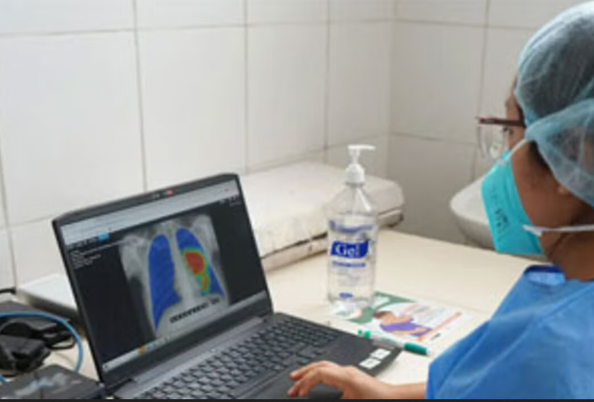 En Pando confirman 34 personas con tuberculosis en lo que va del año