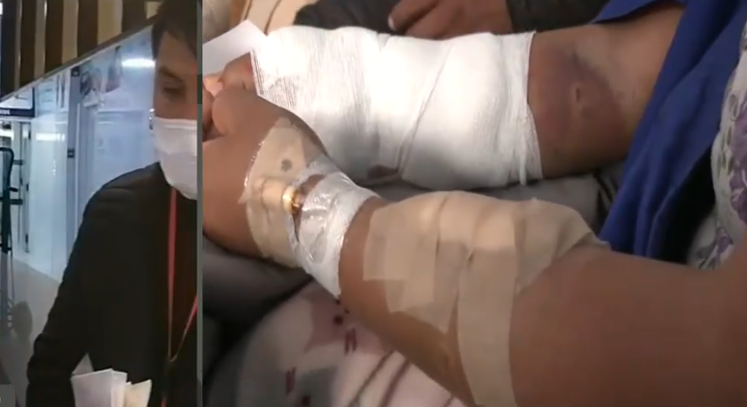 Mujer atacada por tres perros pitbull en El Alto pide ayuda para pagar sus gastos médicos