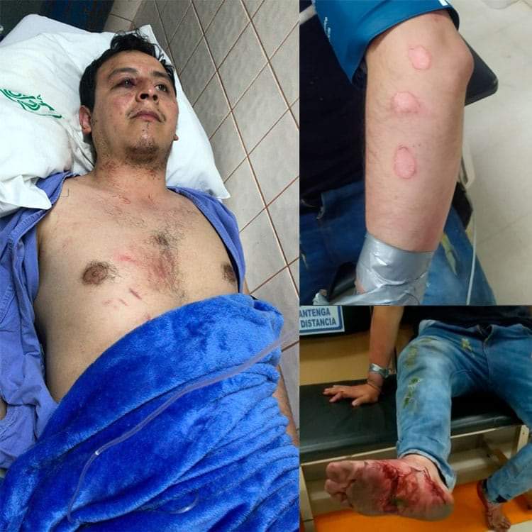 Asamblea de Derechos Humanos repudia actos de tortura de UJC contra un funcionario público 