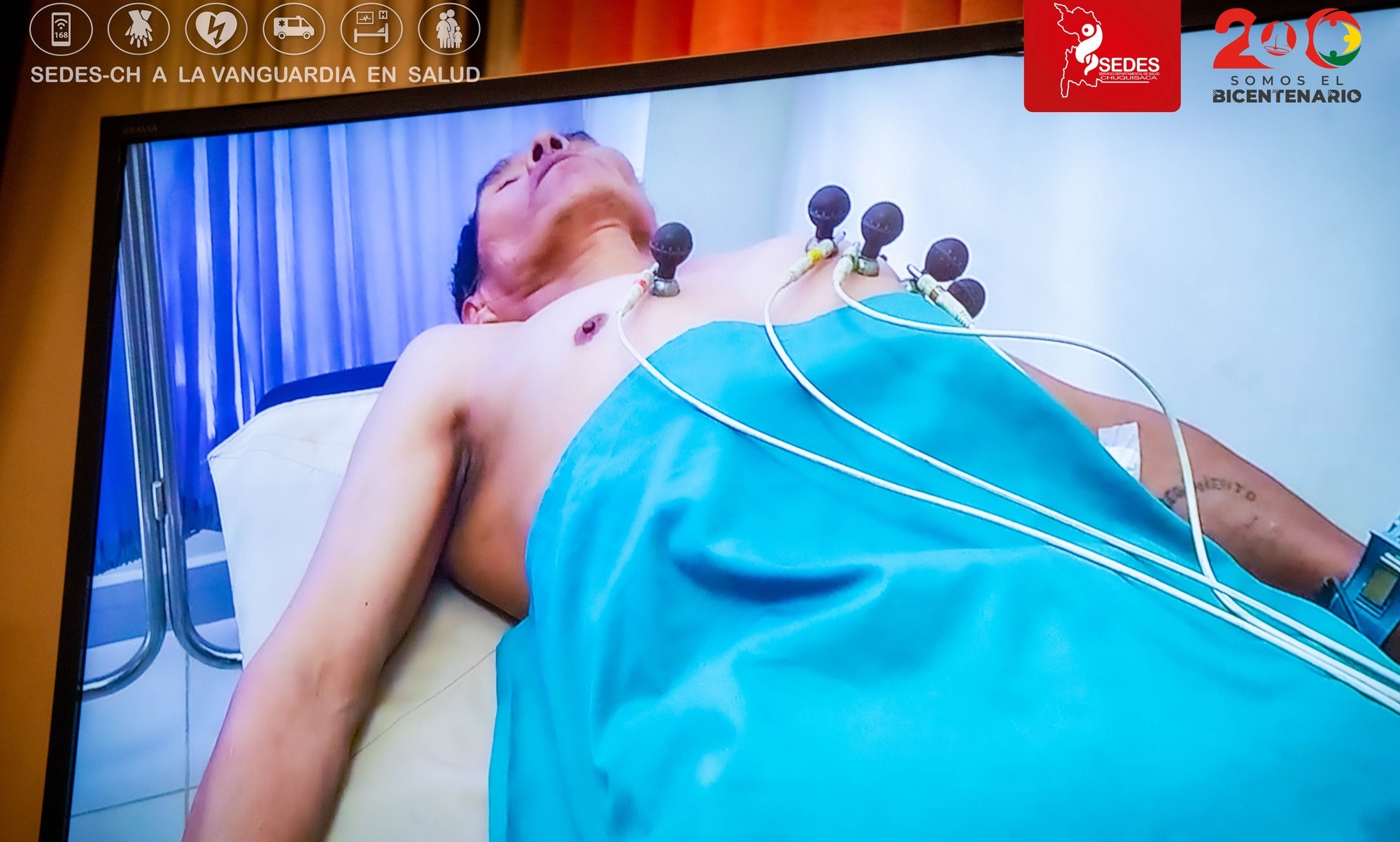 Paciente en control del corazón por marcapaso. Foto: Sedes Chuquisaca.